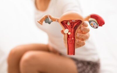 أعراض تكيس المبيض
